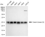 CK2 beta Antibody in Western Blot (WB)