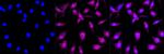 CBS Antibody in Immunocytochemistry (ICC/IF)