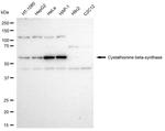 CBS Antibody in Western Blot (WB)