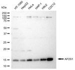 AP2S1 Antibody in Western Blot (WB)