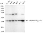 TDP-43 Antibody in Western Blot (WB)