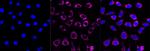 ACAA2 Antibody in Immunocytochemistry (ICC/IF)