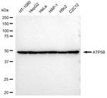 ATP Synthase beta Antibody in Western Blot (WB)