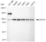 gamma Adaptin Antibody in Western Blot (WB)