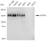 ATP7B Antibody in Western Blot (WB)