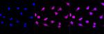 IFT88 Antibody in Immunocytochemistry (ICC/IF)