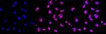 TDP-43 Antibody in Immunocytochemistry (ICC/IF)