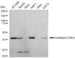 Cathepsin H/K/L/V Antibody in Western Blot (WB)