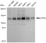 GTF2I Antibody in Western Blot (WB)