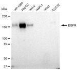 EGFR Antibody in Western Blot (WB)