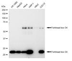 FOXO4 Antibody in Western Blot (WB)