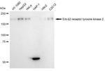 ErbB2 (HER-2) Antibody in Western Blot (WB)