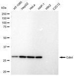 CDK4 Antibody in Western Blot (WB)