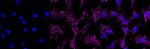 ITGA5 Antibody in Immunocytochemistry (ICC/IF)