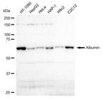 Albumin Antibody in Western Blot (WB)