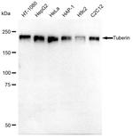 TSC2 Antibody in Western Blot (WB)