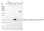 p27 Kip1 Antibody in Western Blot (WB)