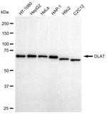 DLAT Antibody in Western Blot (WB)