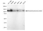 Amyloid Precursor Protein Antibody in Western Blot (WB)