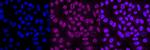 beta Arrestin 1 Antibody in Immunocytochemistry (ICC/IF)