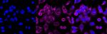 TSC2 Antibody in Immunocytochemistry (ICC/IF)