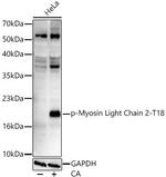 Phospho-MYL2 (Thr18) Antibody in Western Blot (WB)