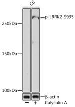 Phospho-LRRK2 (Ser935) Antibody in Western Blot (WB)