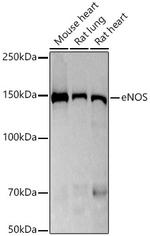 eNOS Antibody in Western Blot (WB)