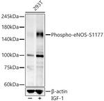 Phospho-eNOS (Ser1177) Antibody in Western Blot (WB)