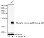 Phospho-MYL2 (Ser19) Antibody in Western Blot (WB)