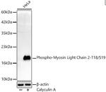 Phospho-MYL2 (Thr18, Ser19) Antibody in Western Blot (WB)