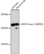 DAPK1 Antibody in Western Blot (WB)