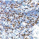 IRF4 Antibody in Immunohistochemistry (Paraffin) (IHC (P))