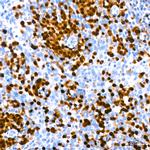 IRF4 Antibody in Immunohistochemistry (Paraffin) (IHC (P))