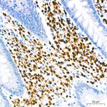 IRF4 Antibody in Immunohistochemistry (Paraffin) (IHC (P))