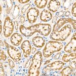 Metadherin Antibody in Immunohistochemistry (Paraffin) (IHC (P))