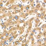 Metadherin Antibody in Immunohistochemistry (Paraffin) (IHC (P))