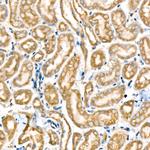 Metadherin Antibody in Immunohistochemistry (Paraffin) (IHC (P))