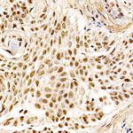 MDM2 Antibody in Immunohistochemistry (Paraffin) (IHC (P))