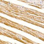 CD273 (B7-DC) Antibody in Immunohistochemistry (Paraffin) (IHC (P))