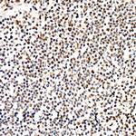 Phospho-PERK (Thr982) Antibody in Immunohistochemistry (Paraffin) (IHC (P))