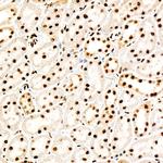 Phospho-PERK (Thr982) Antibody in Immunohistochemistry (Paraffin) (IHC (P))