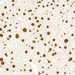 Phospho-PERK (Thr982) Antibody in Immunohistochemistry (Paraffin) (IHC (P))