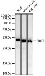 SIRT5 Antibody in Western Blot (WB)