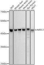 ADSS Antibody in Western Blot (WB)