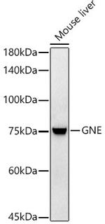 GNE Antibody in Western Blot (WB)