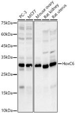 HOXC6 Antibody in Western Blot (WB)