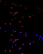 KCNN3 Antibody in Immunocytochemistry (ICC/IF)