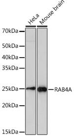 Rab4 Antibody in Western Blot (WB)