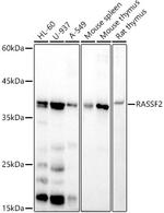 RASSF2 Antibody in Western Blot (WB)